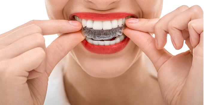 3 Orthodontic Treatments for You